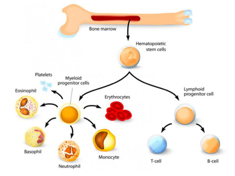 Disease Info | Aplastic Anemia & Myelodysplasia of